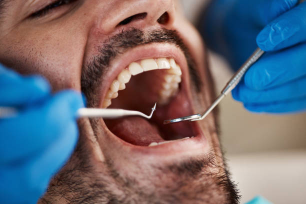 Best Broken Tooth Emergency  in West Fargo, ND